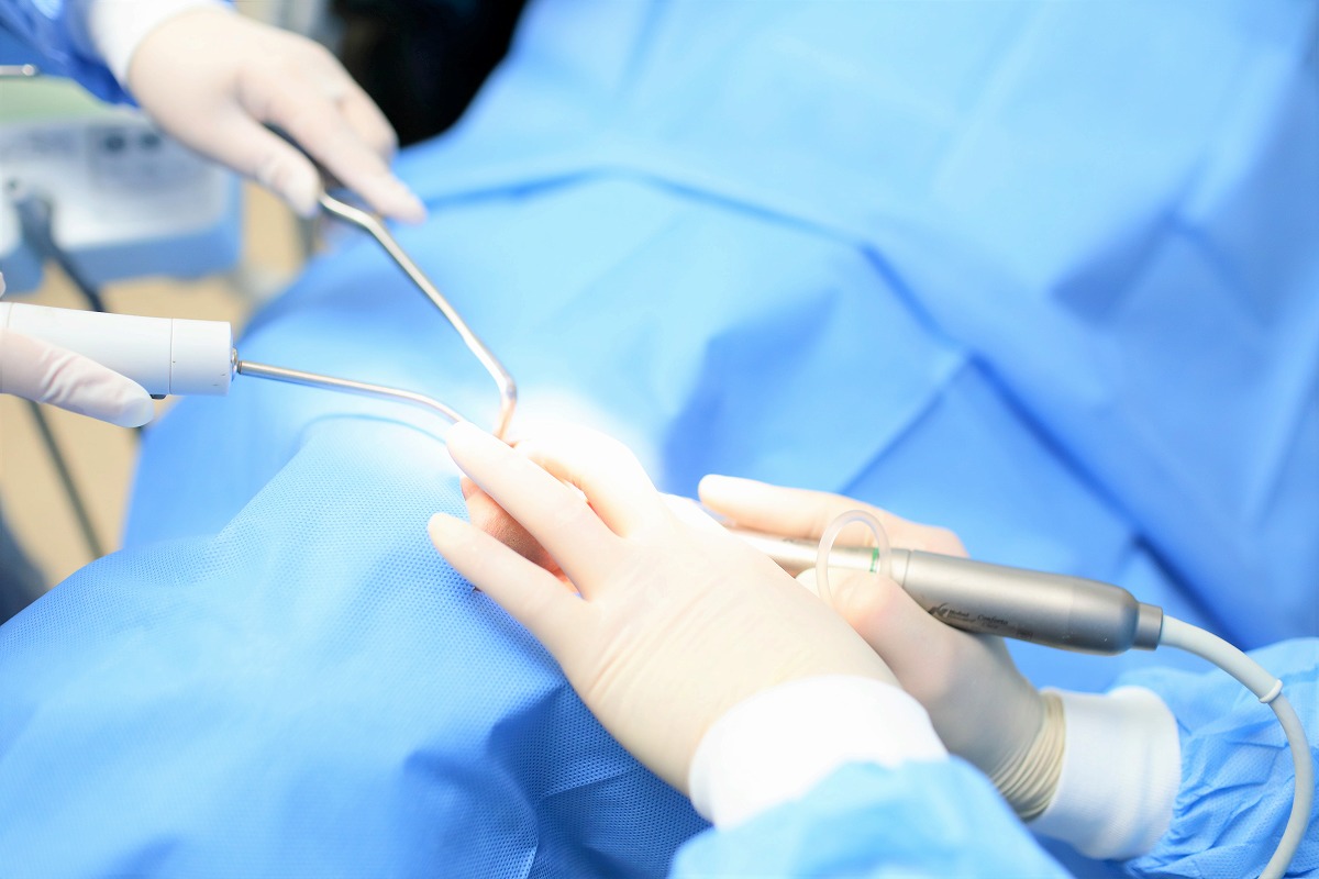 根管治療では治せない歯を残すための外科的歯内療法にも対応